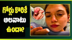 గోర్లు కొరికే అలవాటు ఉందా? ఈ షాకింగ్ ఘటన తెలిస్తే ఇక ఆ పని చేయరు!