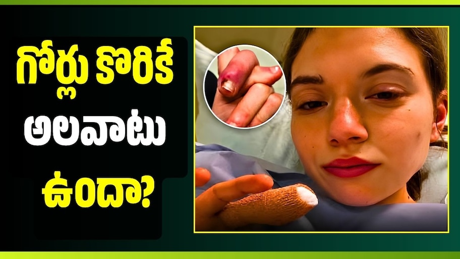 గోర్లు కొరికే అలవాటు ఉందా? ఈ షాకింగ్ ఘటన తెలిస్తే ఇక ఆ పని చేయరు!
