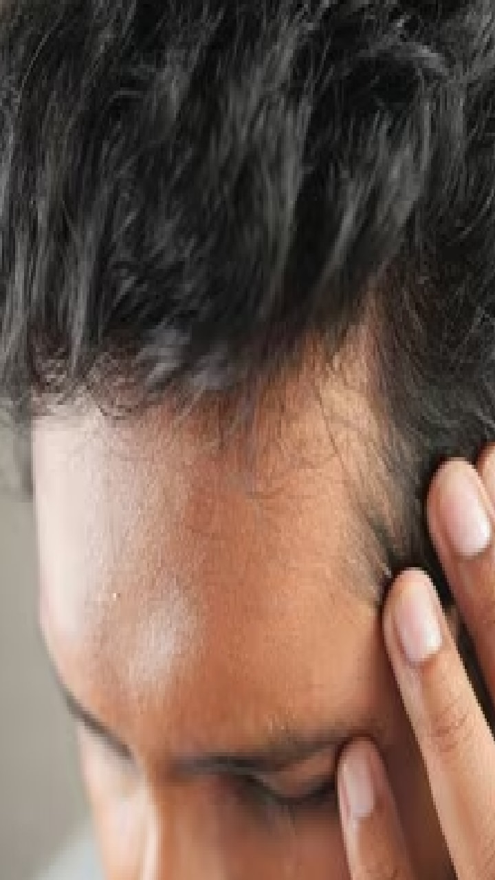 Hair Loss: చిన్న వయసులోనే జుట్టు ఊడిపోతోందా.. ఈ కారణాలు తెలుసుకోండి..!