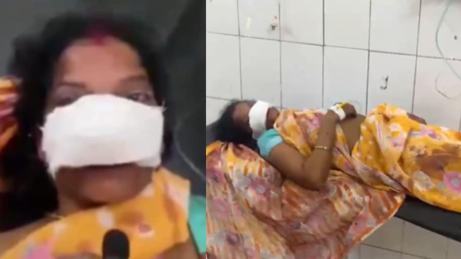 Uttar Pradesh:  యూపీలో బైటపడ్డ మరో ఘోరం.. భార్య ఛాతిపై కూర్చుని ముక్కు నరికేసిన భర్త.. వీడియో..