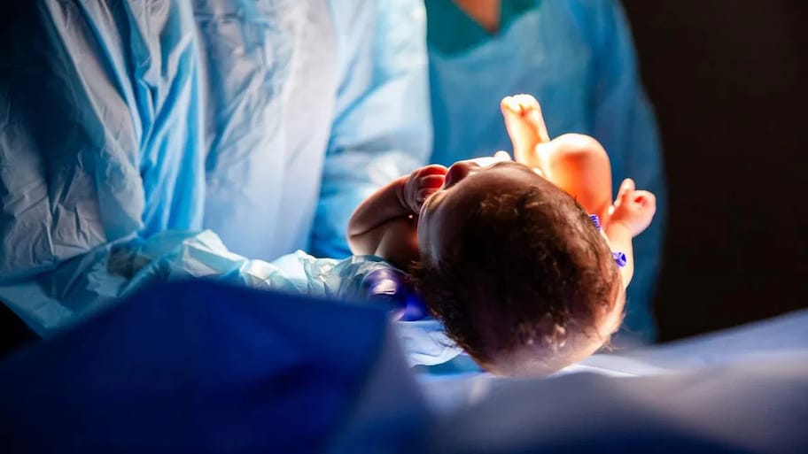 Telangana C Section Rate: తెలంగాణలో పెరుగుతున్న సిజేరియన్ ప్రసవాలు.. గ్రామీణ జిల్లాల్లో 80 శాతానికి పైగా..!
